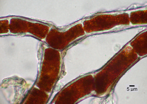 Trentepohlia (alga) species - Branches, microscopic view